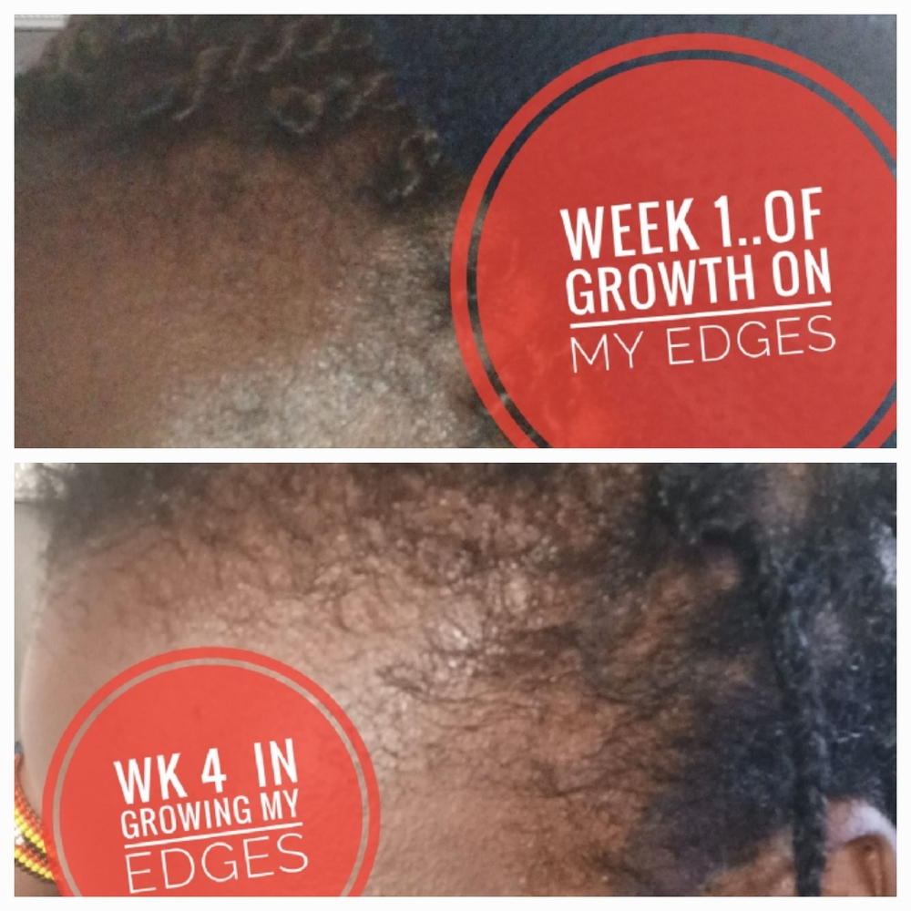 Hair growth oil